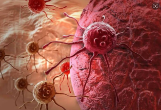 击败癌症 科学家研发神奇“纳米药丸”