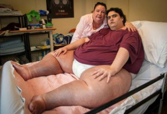 英国317kg“最肥胖男人”器官衰竭过世 享年33岁