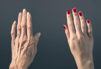 如何让手更白嫩 日常手部保养的5个方法