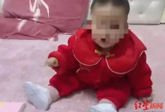 1岁女婴铊中毒瘫痪 其父中毒身亡 投毒者为大伯母！