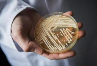 “超级致命菌”爆发一年狂增95% 加拿大已出现