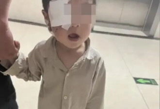 悲剧！河南3岁男童被恶狗咬伤，打了疫苗仍离世