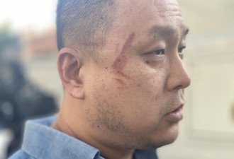 “混帐中国人” 华裔前美国陆战队员 遭辱骂围殴