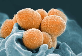 日本爆发“食肉菌”疫情，你应该知道这些
