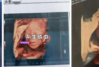 一张超声图就能让AI预测胎儿长相?揭秘AI生图隐忧