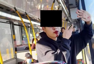 中国留学生在新西兰坐公交遇袭 被金属棍打掉牙