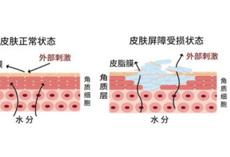 什么是敏感肌肤？有哪些表现？