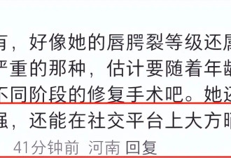 李嫣手术照鼻子唇部包裹严实，配文“轻舟已过”，网友纷纷祝福