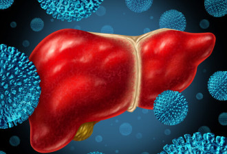 眼睛、皮肤发黄，尿像浓茶…医生寻找“真凶”