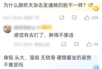 31岁杨紫近照脸僵,事实证明她被&quot;困&quot;在宋丹丹...