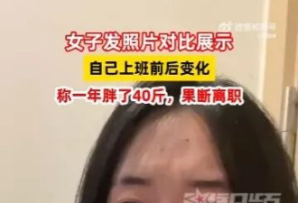 “过劳肥”是真的！女生上班1年竟增20公斤 离职3个月后判若两人