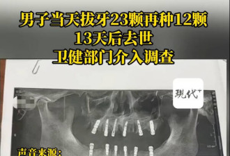 1天内拔牙23颗、植牙12颗 中国男疼痛死亡