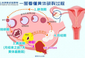 跳健身操导致黄体破裂 这些行为要小心