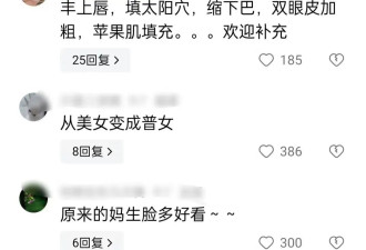 赵露思整容风波闹大了，张大大刘梓晨发声，贾玲无辜被牵连