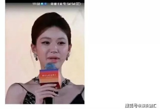 赵露思深陷“整容”风波，她的变美碍了谁的路？