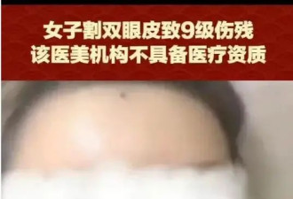 女子双眼皮手术眼睛难闭合,门诊被罚20万赔偿85万