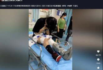 19岁网红女骑士石膏车祸身亡！骑车虽然拉风，可一旦出事后果严重