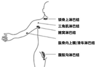 孩子脖子、耳后出现这种软疙瘩 家长千万别瞎按