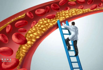 高血脂会遗传,年轻时就有迹象 3种情况就该查血脂