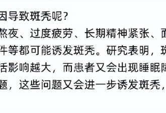 张馨予西藏拍戏出现斑秃，称经常呕吐睡不好，精神身体压力过大