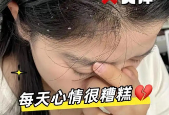 头屑多、瘙痒？健康头皮如何“养”出来