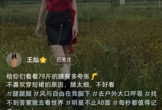 杜淳老婆暴瘦不足80斤，穿短裙瘦成“闪电”，长腿细得像麻杆