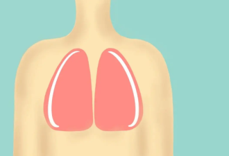 患上肺癌 除了咳嗽还要注意4个异常