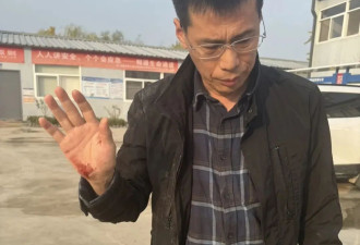 2名记者采访时被打伤手机被抢走，负责人叫嚣...