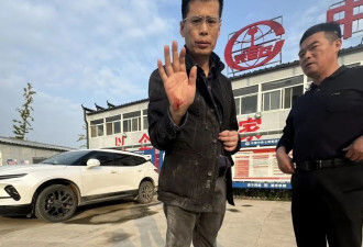 2名记者采访时被打伤手机被抢走，负责人叫嚣...