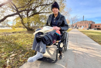 患者截肢右腿竟然被截左腿，加拿大医生笑着道歉…