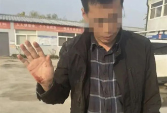 被打伤的“硬汉记者” 曾遭周焯华多次威胁