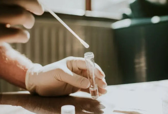 女病毒学家给自己注射病毒：肿瘤缩小 切除后未复发