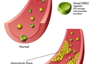 上海瑞金研究：胆固醇越低 癌症风险越高？