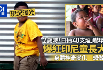 印尼“2岁抽烟”男童曾吓坏全球 16岁现况曝光