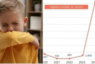 超级传染病毒席卷! 大批华人中招 ! 加拿大1.2万人感染!