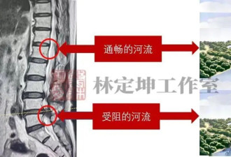 快改！中老年腰腿痛别瞎练 这些锻炼都做错了