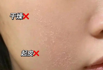 干燥脱皮？秋冬季护肤指南来了