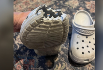 多伦多10岁女孩穿Crocs鞋上电梯：人被突然甩飞，鞋头严重撕裂！