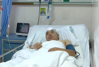 男子因不喝酒被朋友揍进ICU,头盖骨取出来10多块