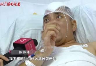 男子因不喝酒被朋友揍进ICU,头盖骨取出来10多块