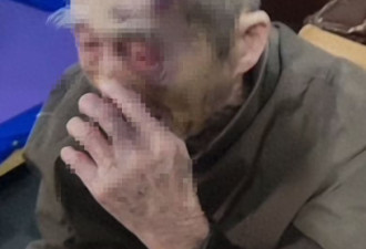 画面揪心!广东90多岁老人遭养老院护工殴打近一年