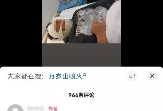 13岁男孩练习喷火表演被烧伤？河南万岁山景区：他是游客