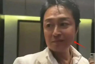 61岁马景涛老成这样了！面部浮肿嘴歪眼斜，头发稀疏眼神呆滞