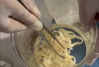 女子体内排出10米长绦虫,原是旅游时吃了这种食物