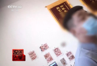 口腔医疗乱象：8家诊所给出4种看牙方案