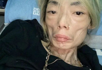 豪门玩物，8年被折磨成牙齿全掉，不足80斤，形似骷髅，惨不忍睹