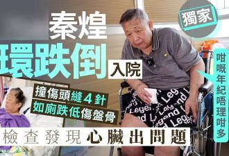 76岁港星在养老院摔得遍体鳞伤，换了4间医院救治，已看淡生死