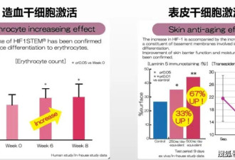 人类预期寿命将止于87岁？