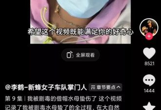 冲浪爱好者称在海南三亚被僧帽水母蜇伤