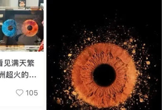 突然走红！有人开始给眼珠拍写真，医生紧急提醒